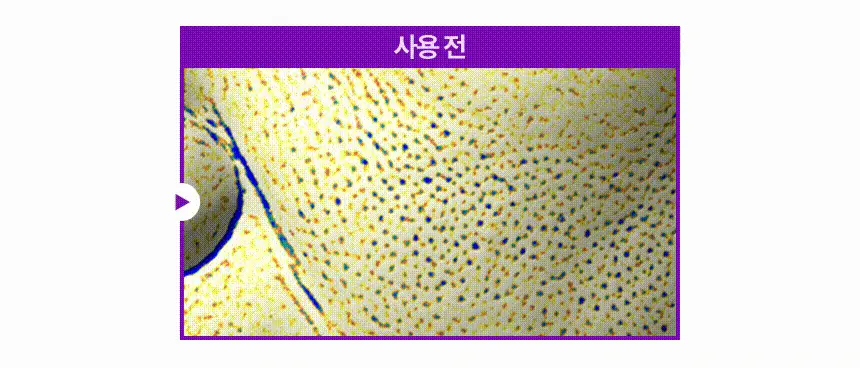 [NEW 탄력스피큘] 앰플엔 하이퍼샷 펩타이드 앰플 50ml 상세페이지 20